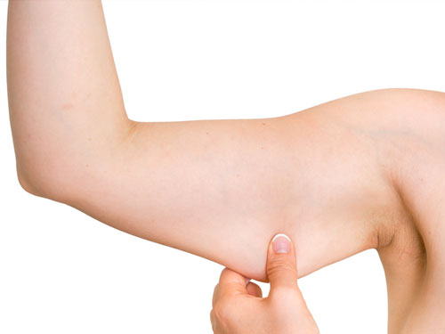 docteur adjadj chirurgie plastique bras brachioplastie lifting face interne bras amaigrissement perte de poids retendre les tissus 