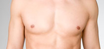 cure-gynecomastie