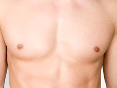 int-gynecomastie