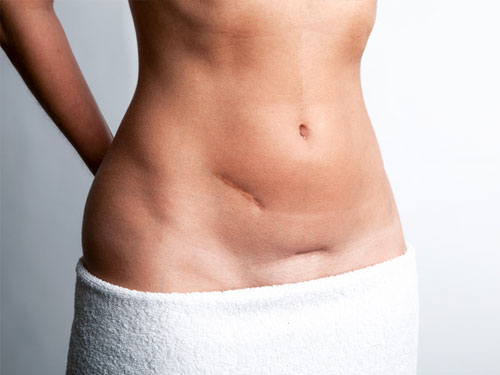 docteur adjadj chirurgie plastique médecine esthétique cicatrice correction